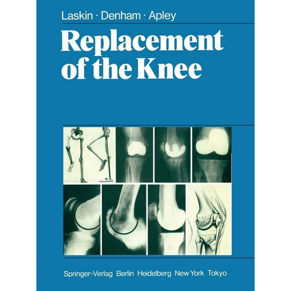 Replacement of the Knee, (Paperback)