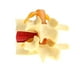thumbnail image 3 of Nuevo o De Protrusión D Intervertebral De Zulema Estatua de protrusión del disco lumbar, 3 of 7