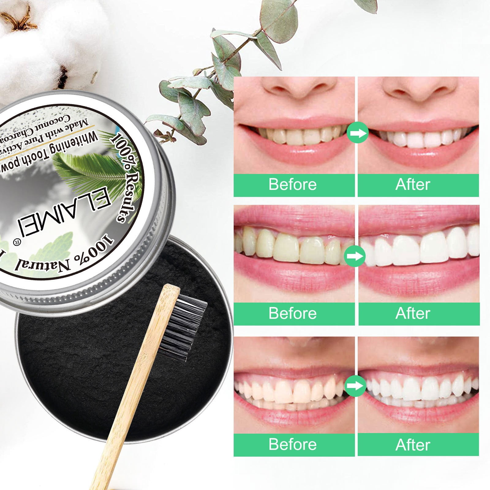 Go Teeth ning Trays Receding Gums Mouthwash Stuff for Braces Toothbrush Wireless Charging Powe Toothbrush for Adults Toothbrush for Braces Teens Teeth Spacers Toothbrush And