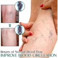 thumbnail image 2 of Veinopro Varicose-veins Treatment Soap Wormwood Soap Promote Blood Circulation, 2 of 5