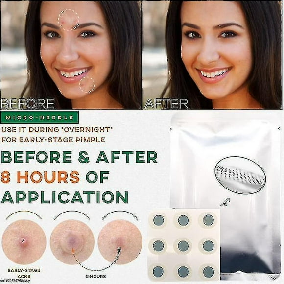 Invisible 9 Patches Microneedle Acne Pimple Healing Patch