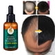 thumbnail image 3 of Líquido De Crecimiento De Jengibre 30ml ANGGREK Suero Anti Pérdida Crecimiento Del Cabello, 3 of 6
