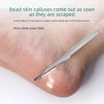 thumbnail image 2 of Cuchillo de pedicura, técnico profesional, traje especial, cuchillo de tres mangos, ranura para uñas, herramienta de pedicura para uñas grises, herramienta para la inflamación, pieza única para el, 2 of 5