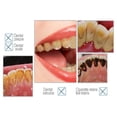 thumbnail image 3 of Removedor eléctrico de cálculos dentales, de de sónicos, herramientas de limpieza con cabezales limpios reemplazables, 4 modos Rosado Macarena  escalador ultrasónico, 3 of 7