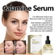 thumbnail image 4 of Xihbxyly Oferta del día Liquidación Suero de calamina Centella asiática fotosensible, hidrata, cierra los poros, aclara y blanquea la pie del rostro, 30 ml, 4 of 7