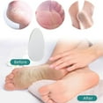 thumbnail image 5 of Glass Foot File Callus Remover with Large Scrubbing Surface for Wet and Dry Use, Painless Dead N Exfoliation for Soft Heels, Ideal for At-home Pedisolutions and Travel Grooming Kits, 5 of 9