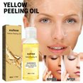 thumbnail image 1 of Acetato Exfoliante Blanqueador E Hidratante Xihbxyly 50 ml Para Pieles Sensibles, 1 of 7