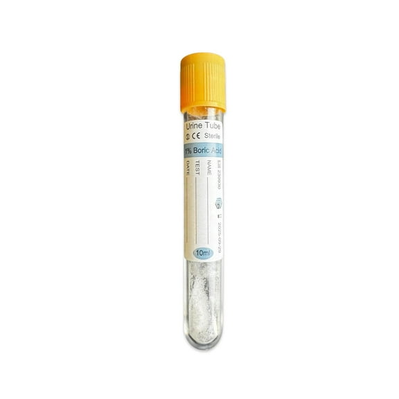 200 Tubes Vacuum urine tube, Yellow cap, 16*100mm