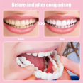 thumbnail image 4 of Carillas dentales Juego de fundas para dientes Dentaduras postizas Carillas dentales Funda a presión Dientes falsos Sonrisa de confianza instantánea Dientes temporales, 4 of 6