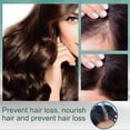 thumbnail image 2 of Productos PARA EL CRECIMIENTO DEL cabello Yuxing con jengibre SUERO líquido anticaída, 2 of 5