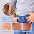 thumbnail image 5 of Men's Private Intimate Cream 20g 2-pack for men Balanitis Itching Repair, 5 of 5