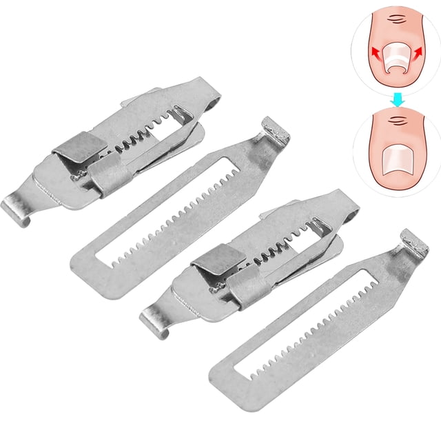 Tira Correctora De Paroniquia, Corrector De Paroniquia De Acero Inoxidable Para Aliviar El Dolor Para Corrección De Uñas De Los Pies