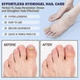 thumbnail image 4 of Fungal Nail Repair Patches, Waterproof Toenail Treatment & Correction Stickers for Damaged Nails_c*, 4 of 5