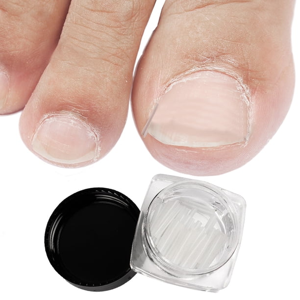 10 Uds. Práctico Clip para alisar las uñas de los pies en el hogar parche adhesivo adhesivo soporte