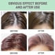 thumbnail image 4 of Spray para cabello seco sin enjuague Jaysuing Oil Control, spray para cabello seco sin enjuague | | 4379407271631, 4 of 5