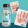 thumbnail image 4 of Stop Nail Biting Treatment - Clear, Bitter-Tasting Nail Polish To Stop Nail-Biting - Easy To Apply and Safe For Children - Nail Strengthener Solution - (0.5 fl oz), 4 of 9