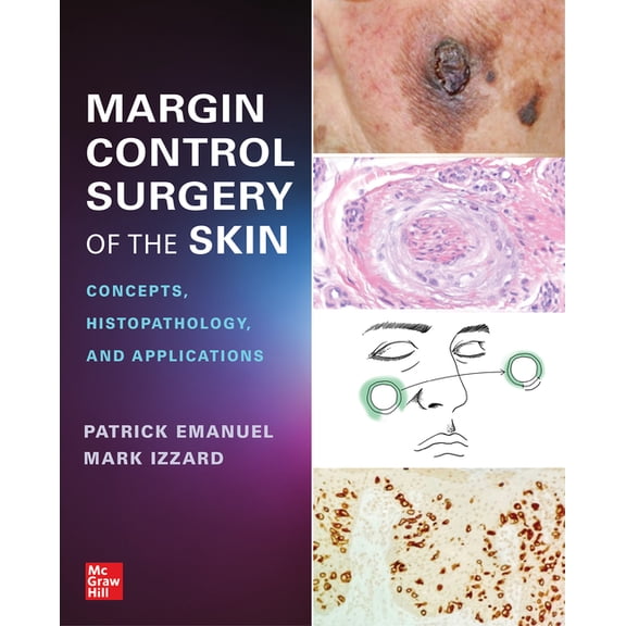 Margin Control Surgery of the Skin: Concepts, Histopathology, and Applications, (Paperback)