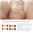 thumbnail image 3 of Corrector de uñas para dedos del pie, pegatinas adhesivas para pulgar encarnado, tratamiento de paroniquia, suministros para ranuras, pedicura, Ayudas para vestirse con gancho de botón Tipo 1 Seitruly CE012270-01B, 3 of 6