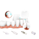 thumbnail image 3 of Pulidor de dientes Cepillo de dientes eléctrico Medidor de belleza para dientes Limpiador dental eléctrico Cepillo de dientes para adultos Limpieza de dientes Manchas de humo Placa dental, 3 of 4
