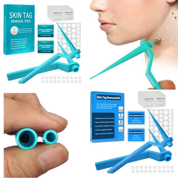 Skin Tag Removal Kit Rubber Bands Skin Tag Removal Bands