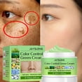 thumbnail image 2 of Crema blanqueadora para pecas, elimina el Melasma, manchas oscuras, ilumina la melanina, ilumina el Melasma, hidrata, antienvejecimiento, cuidado facial Fivean unisex, 2 of 2