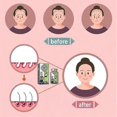 thumbnail image 4 of Ginger Plant Extract Anti-hair Loss Hair Shampoo, 2024 New Ginger Plant Extract Anti-hair Loss Hair Shampoo, Ginger Shampoo For Hair Growth_c*, 4 of 5