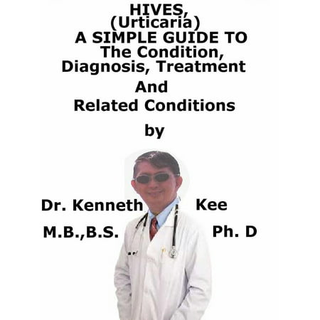 Hives, (Urticaria) A Simple Guide To The Condition, Diagnosis, Treatment And Related Conditions -