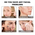 thumbnail image 3 of Parches Para Zit, Pegatinas Protectoras Para Espinillas Durante El Día, 3 of 7