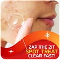 thumbnail image 2 of Crema de tratamiento de manchas de acné con asepxia al 2% de ácido salicílico, 30 ml, 3 unidades, 2 of 8