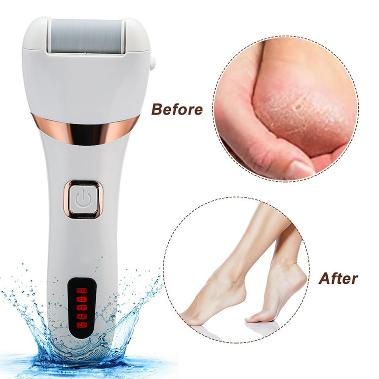 Jsaert Electric Foot Scrubber, Rechargeable Hard Skin Remover Foot
