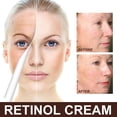 thumbnail image 2 of 30g Retinol Crema antiarrugas Reafirmante Lifting Fade Crema facial antiarrugas para mujeres Ygjytge Cuidado Belleza, 2 of 3
