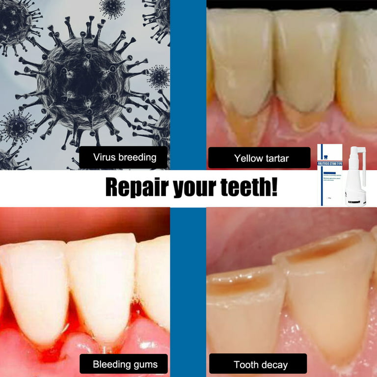 How to Repair Your Teeth