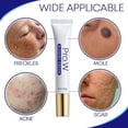thumbnail image 4 of Face Care Removal Ointment Facial Skin, 4 of 5