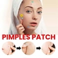 thumbnail image 4 of Parches para espinillas en la cara Parches hidrocoloides para el acné Versátiles y lindos cubre espinillas con forma de estrella Pegatinas para manchas Parches suaves y no irritantes 5 colores 3 tama, 4 of 5