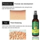thumbnail image 4 of EELHOE Spray para el cabello de jengibre (caja de 50 ml) Fortalecimiento del cabello Masaje del cuero cabelludo Reparación del cabello Solución para el cuidado del cabello,1 piezas, 4 of 9