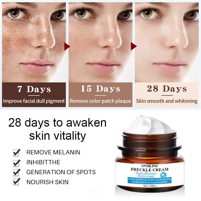 Skin Lighten Spots Remove Freckles Face Cream Natural Ingredients Enriching All Tones Melasma Sun Remover Light - Walmart.com