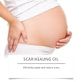 thumbnail image 4 of NEW Essential oils Essential Oil Beauty Removal Scar Premium Compound Oil Cells Reduces Scar Resists Acnes 30ml(buy 2 get 10% off), 4 of 5