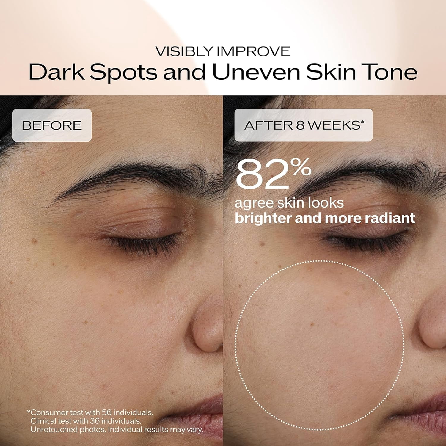 Shiseido Benefiance Brightening and Wrinkle Smoothing Cream 50mL - Moisturizer Visibly Improves Dark Spots & Wrinkles with Plant-Based Retinol - 24HR Hydration - Non-Comedogenic, All Skin Types