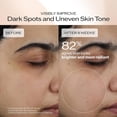 thumbnail image 6 of Shiseido Benefiance Brightening and Wrinkle Smoothing Cream 50mL - Moisturizer Visibly Improves Dark Spots & Wrinkles with Plant-Based Retinol - 24HR Hydration - Non-Comedogenic, All Skin Types, 6 of 9