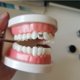 thumbnail image 4 of Venta caliente 8 piezas médicas de titanio puro dientes gemas materiales reales DIY dientes joyería dientes gemas, 4 of 4