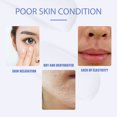thumbnail image 3 of Crema hidratante para pieles secas y sensibles | Hidratación profunda Nutre Repara Barrera | Extractos de fruta de manteca de karité | Restaura la elasticidad | Tubo de 80 g | Hidratación duradera, 3 of 7