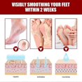 thumbnail image 2 of 5 Pairs Exfoliating Essence Foot Mask Moisturizing Hydrating Remove Dead Skin Skin-friendly, 2 of 5