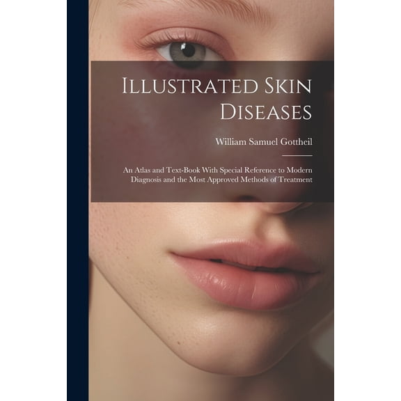 Illustrated Skin Diseases : An Atlas and Text-Book With Special Reference to Modern Diagnosis and the Most Approved Methods of Treatment (Paperback)