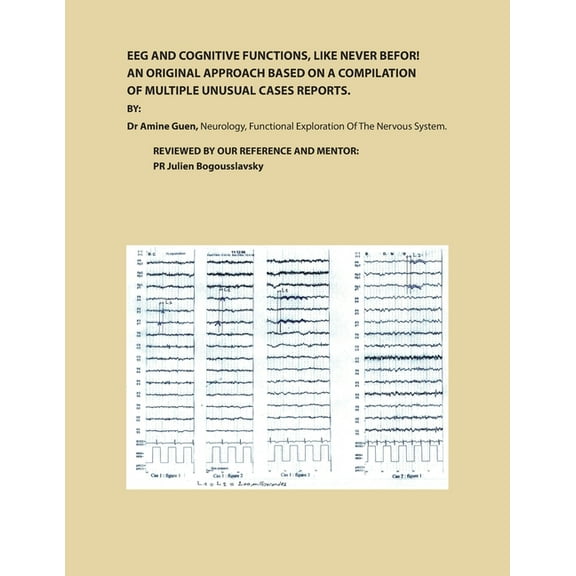 Eeg and Cognitive Functions, Like Never Befor!: An Original Approach Based on a Compilation of Multiple Unusual Cases Re, (Paperback)