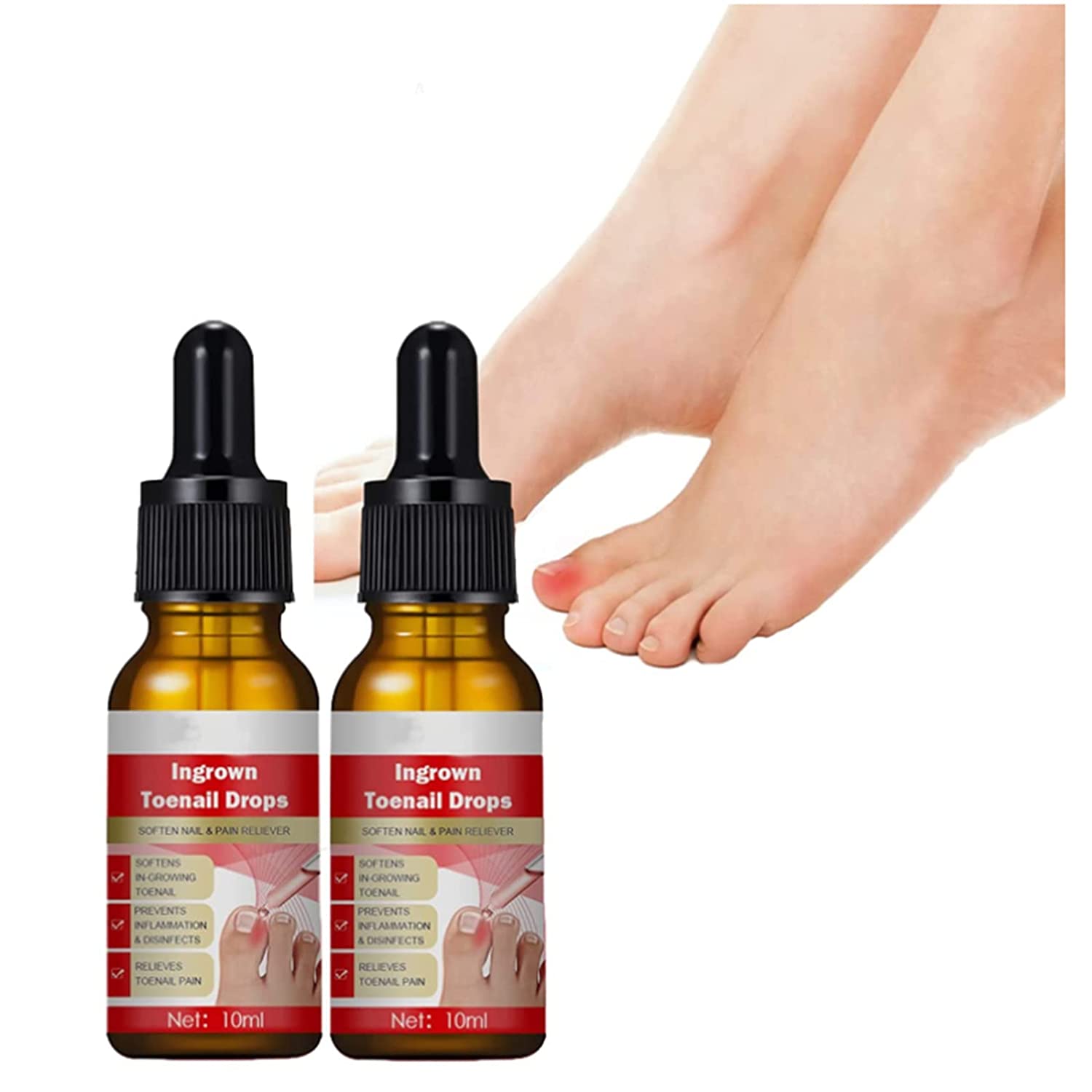 Ingrown Toenail Ingrown Toenail Pain Reliever And Softener Kit For