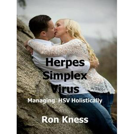 Herpes Simplex Virus - eBook