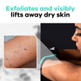 thumbnail image 3 of Guante exfoliante profundo Dermasuri para la ducha, 1 unidad, 3 of 8