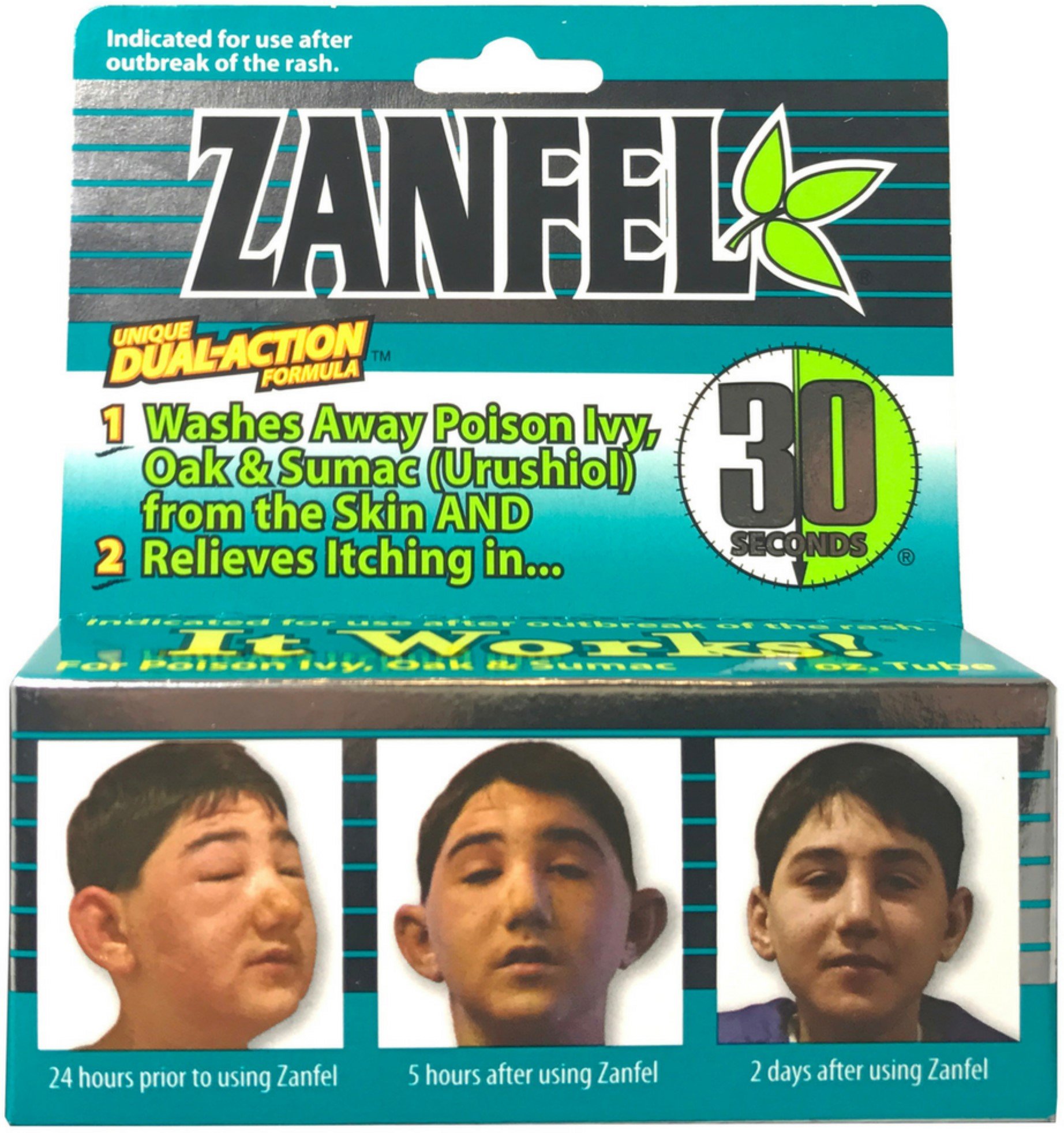 Zanfel Washes Away Poison Ivy Oak & Sumac Tube Dual Action Formula, 1 oz - image 2 of 7