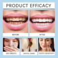 thumbnail image 4 of 60ml Tooth care solution Dentite Cavity Healing Tooth Armor, 4 of 5