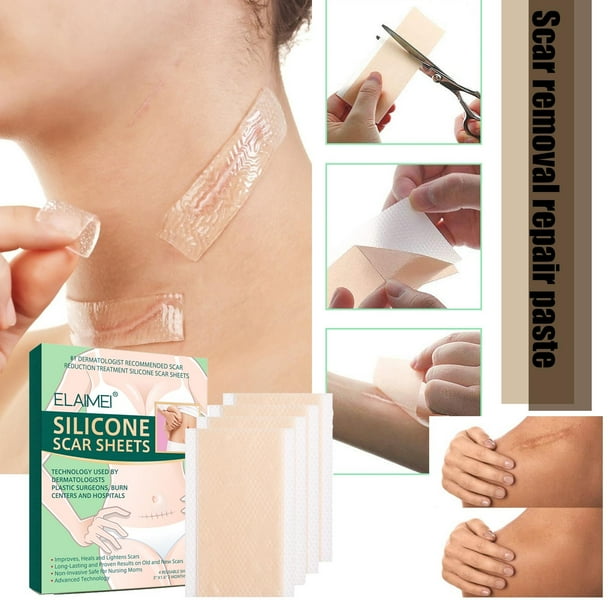 Scar Away Silicone Gel Sheet Patch Cesarean Marks Removal Scar